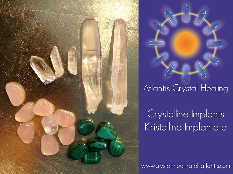 Crystalline Implants